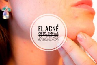 eliminar acne soluciones tratamientos