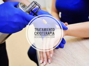 tratamiento crioterapia
