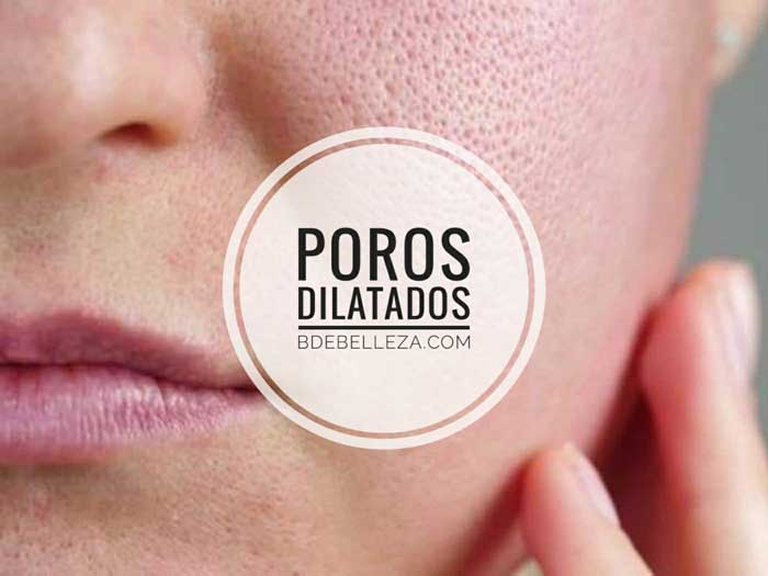 poros dilatados